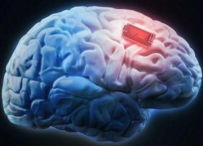 تشخیص بیماری های مغز و اعصاب به کمک فناوری های نوین پزشکی